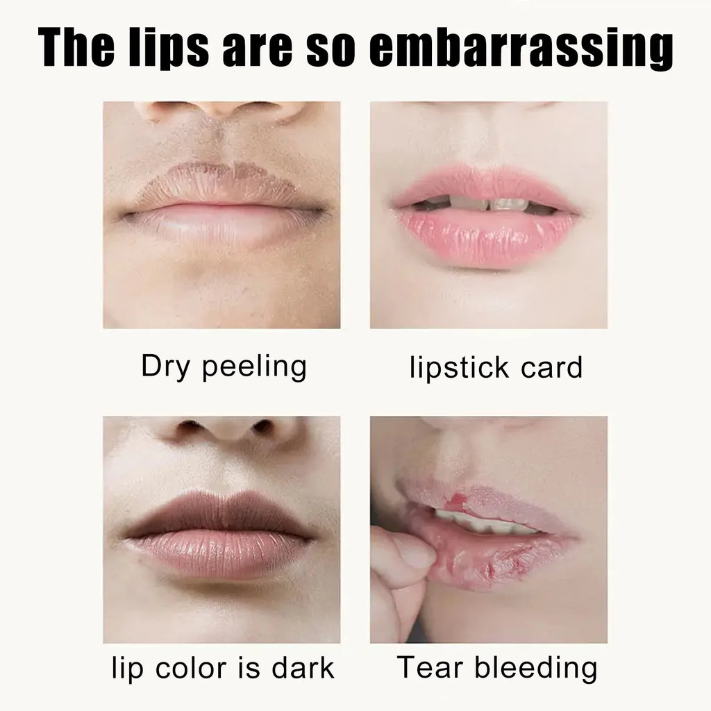 Collagen Cherry Lip Mask Nourishing Repair Lips Plumper Lighten Lines Firming Moisturizing Anti-dryness Labial Gel Patch